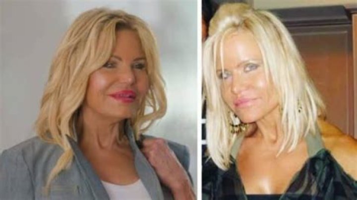 10+ Lisa Helou Plastic Surgery DamianMaleka