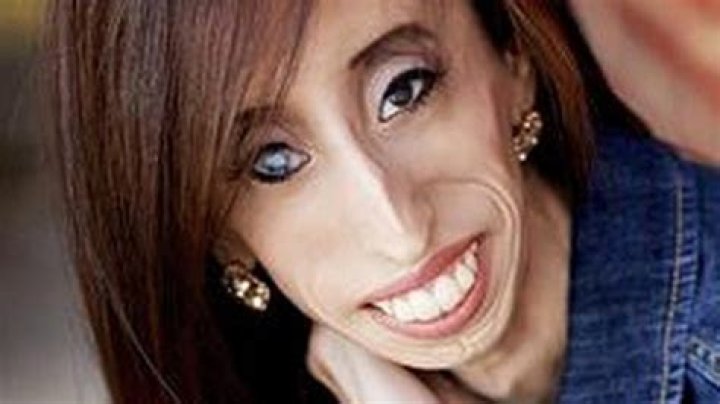 10 Pictures Of HorribleLooking People In The World