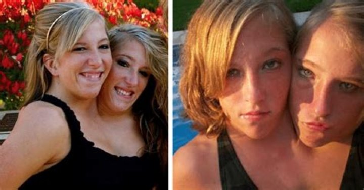 21+ Years After We Met Conjoined Twins Abby And Brittany, They Are All