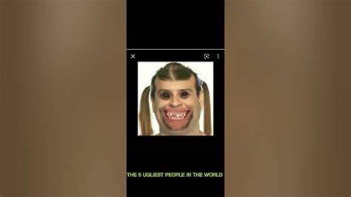 5 Ugliest People In The World You Had No Clue Of Their Existence