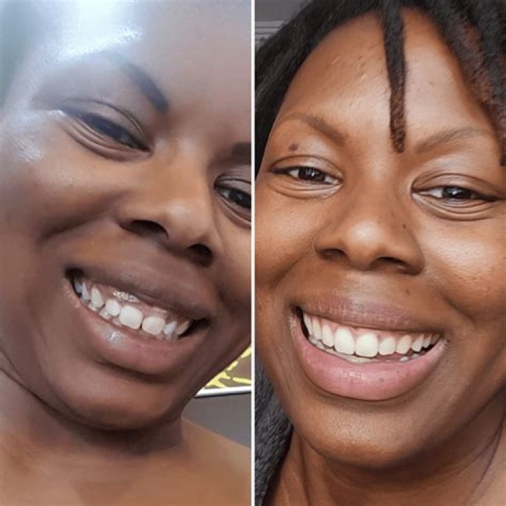 A few more teeth, then retirement Dr. Jenkins calls it a career