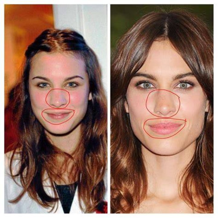 Alexa Chung Weight Loss Before After
