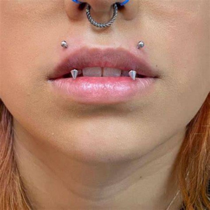 Angel Bites Piercing in 2021 Angel bites, Angel bites piercing, Piercing