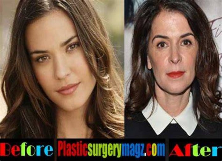 Annabella Sciorra Plastic Surgery Body Measurements, Facelift, Nose