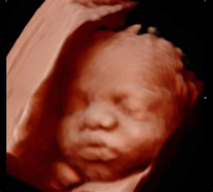 baby with big lips on ultrasound blackbodyart