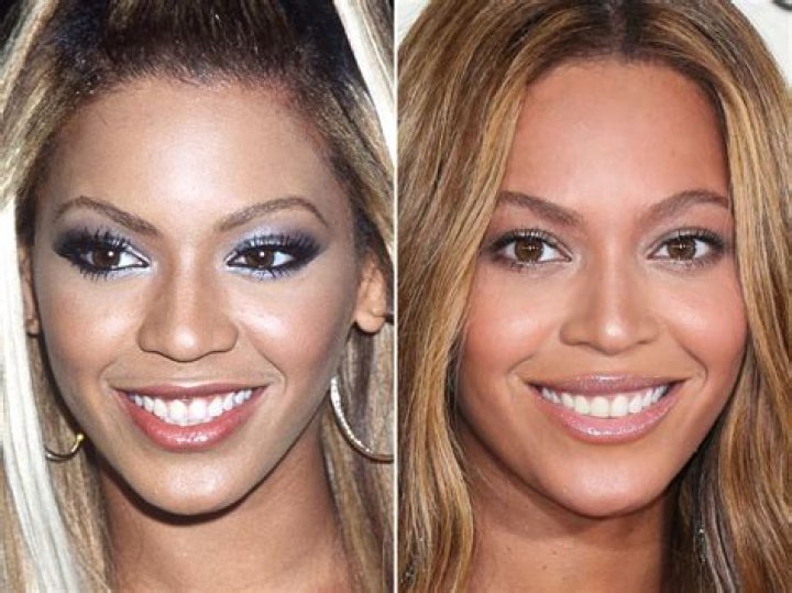 Beyonc&eacute;, Before and After Beyonce, Clear skin fast, Simple skincare