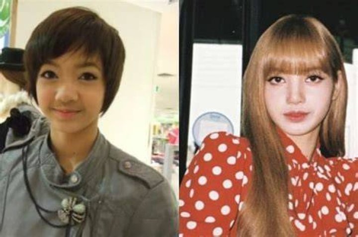 Blackpink Lisa Before And After Surgery In Hd Images Lisa Hot Sex Picture