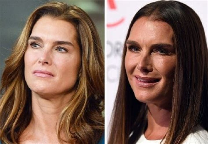 BROOKE SHIELDS Brooke Shields, Facelift, Being Ugly, Actors & Actresses