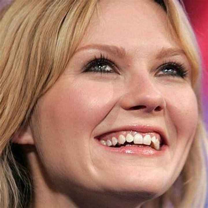 Celebrities with Bad Teeth (13 pics)