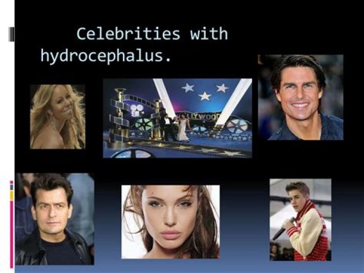 Celebrities with Hydrocephalus