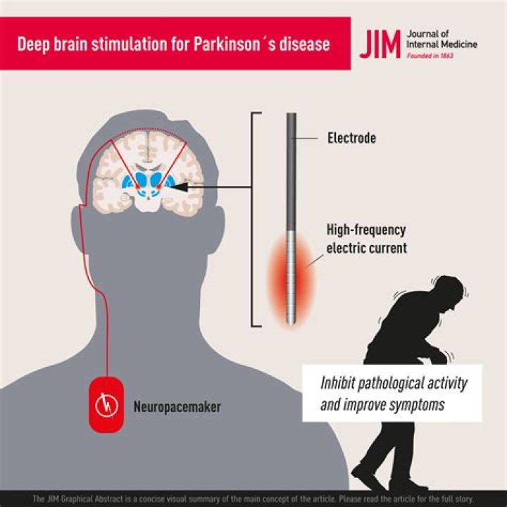 Chuck Todd Parkinsons Disease