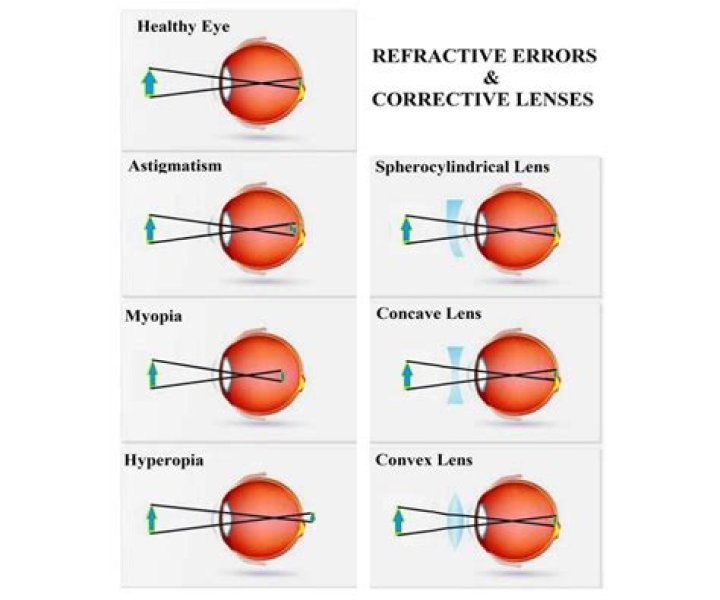 Contact lenses and Eyes &mdash; KAZU HIRO