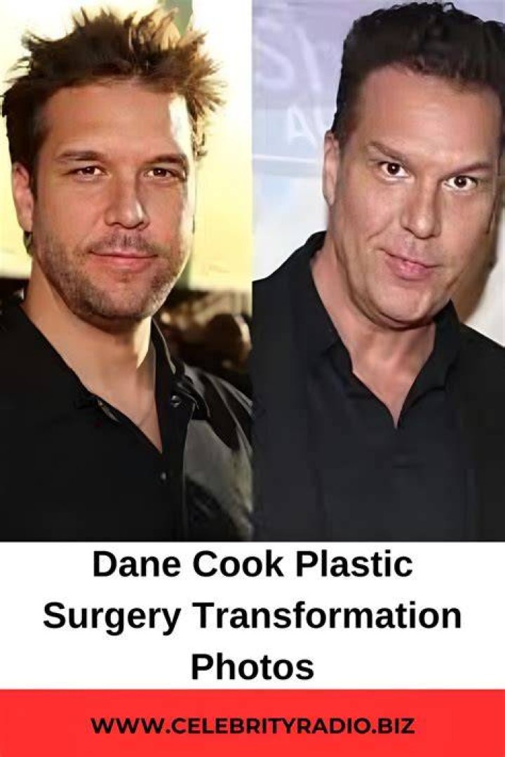 Dane Cook Plastic Surgery Photos [Before & After] Surgery4