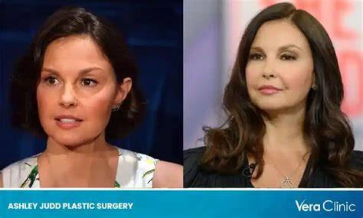 Did Ashley Judd Get Plastic Surgery? Transformation Photos Life & Style