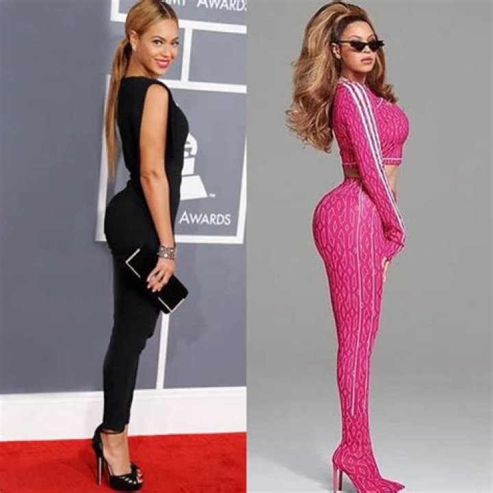 Did Beyonce Get A BBL? Before And After Photos