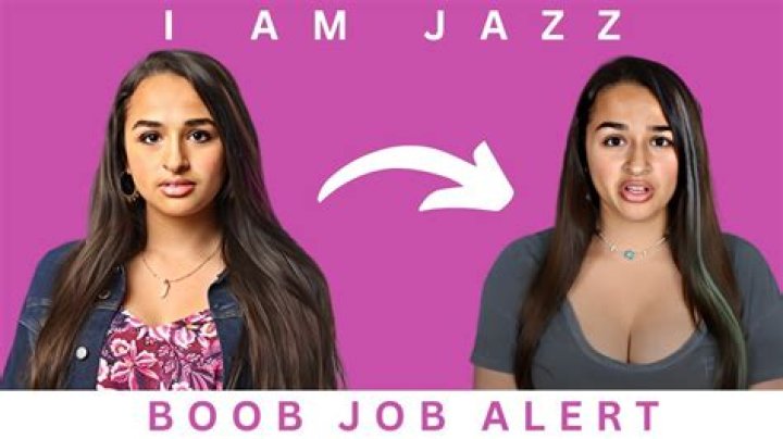 Did Jazz Get A Boob Job?! I Am Jazz YouTube