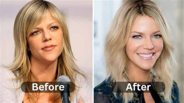 Did Kaitlin Olson Undergo Plastic Surgery Including Boob Job and Nose