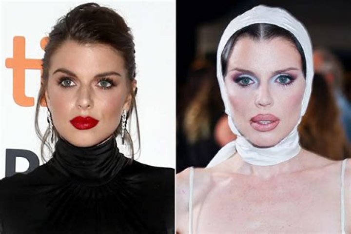 Did Mary Bruce Get Plastic Surgery? Body Measurements and More
