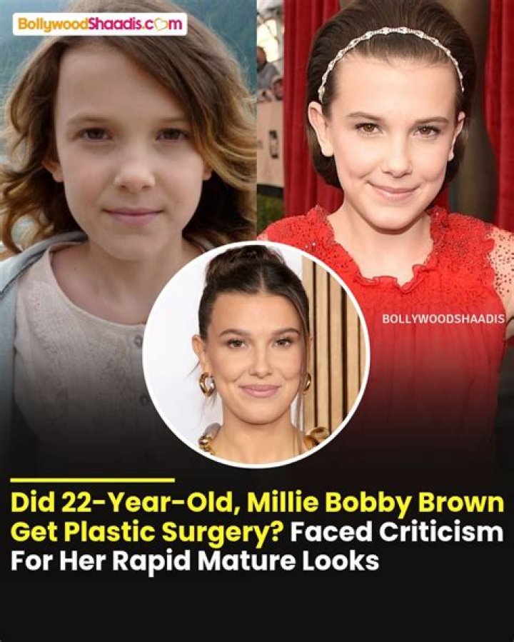 Did Millie Bobby Brown Undergo Nose Job And Lip Filler? Truths About