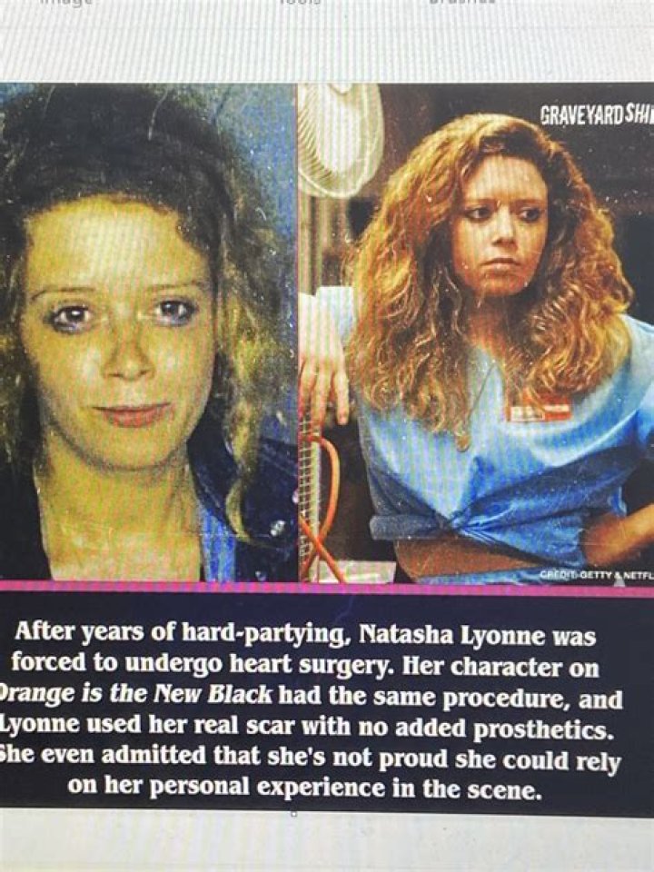 Did Natasha Lyonne Have Heart Surgery? All the Facts Here!
