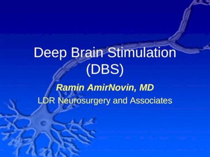 Dr. AmirNovin Deep Brain Stimulation (DBS) surgery Univision (Part 2