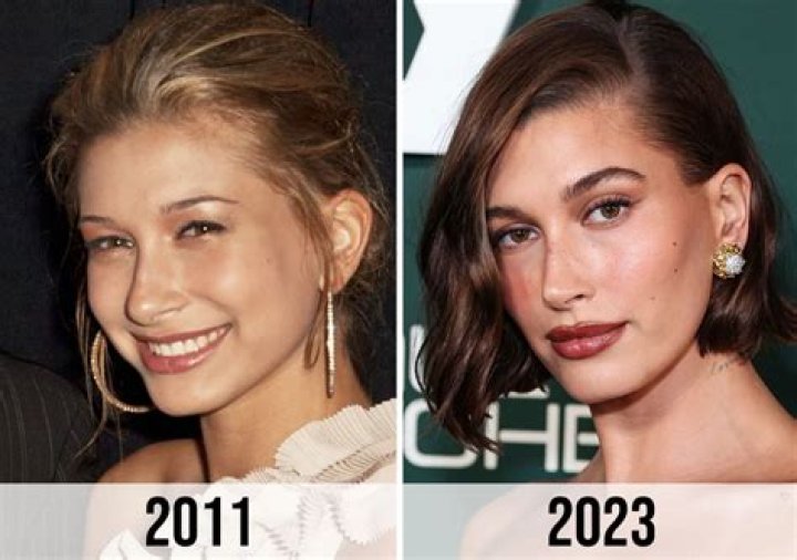 Hailey Bieber responds to plastic surgery rumor after &lsquo;crazy