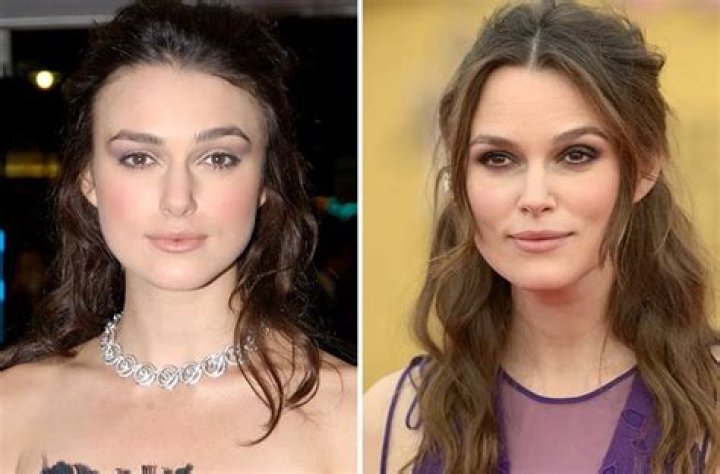 Has Keira Knightley Had Plastic Surgery? Body Measurements and More