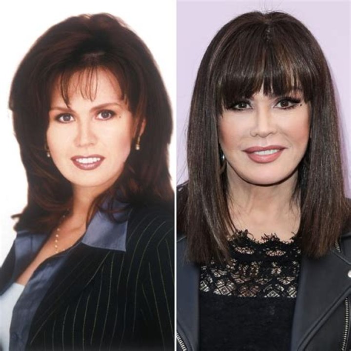 Has Marie Osmond Gotten Plastic Surgery? Our Experts Weigh In!