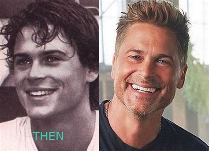 Has Rob Lowe had plastic surgery?