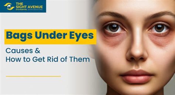 having light eyes is a cheatcode Men's Self