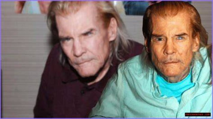 How did Jan Michael Vincent fare? How Did He Amputate His Leg?