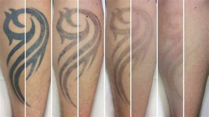 How Many Tattoo Zach Edey Have? Their Meanings And Designs