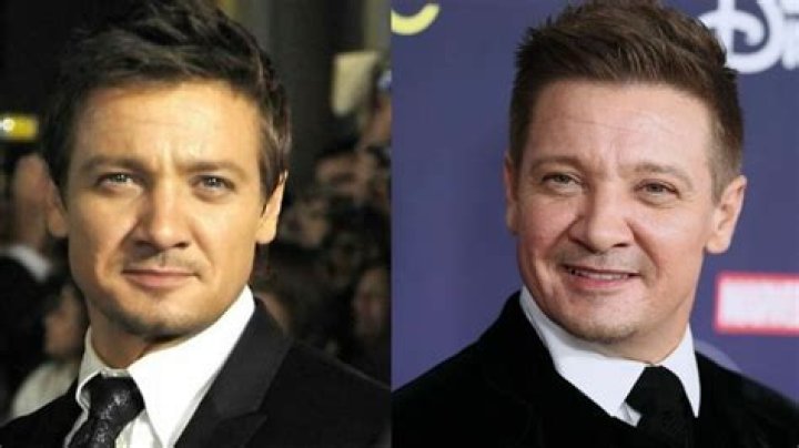 Jeremy Renner out of surgery after snow plow accident