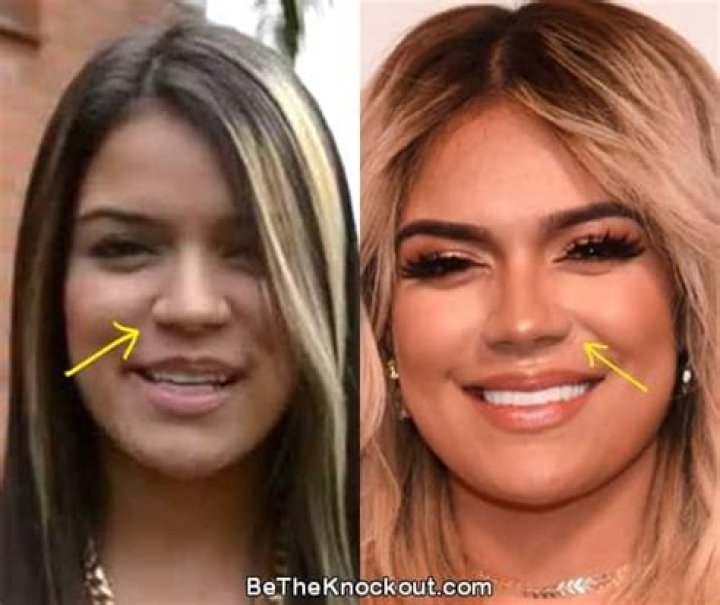 Karol G BEFORE and AFTER 2022