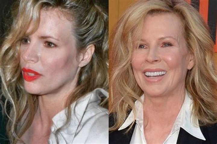 Kim Basinger Plastic Surgery Before and After Celebrity Sizes