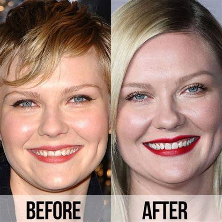 Kirsten Dunst Plastic Surgery Before After Breast Implants The Best
