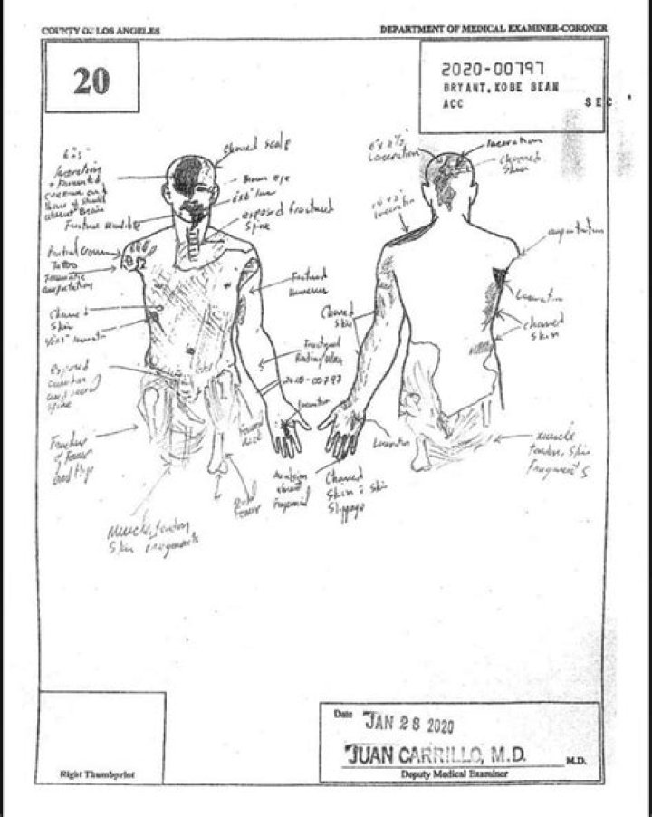 Kobe Bryant Autopsy Pictures Sketches Leak Online