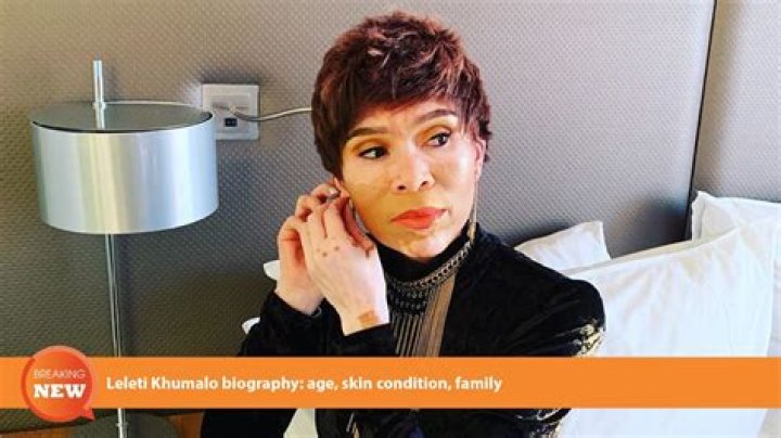 Leleti Khumalo biography age, skin condition, twins, husband, and