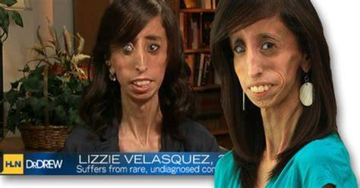Lizzie Velasquez bullies called me the world's ugliest woman