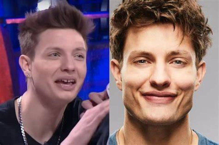 Matt Rife Before And After Did The Comedian Undergo Plastic Surgeries