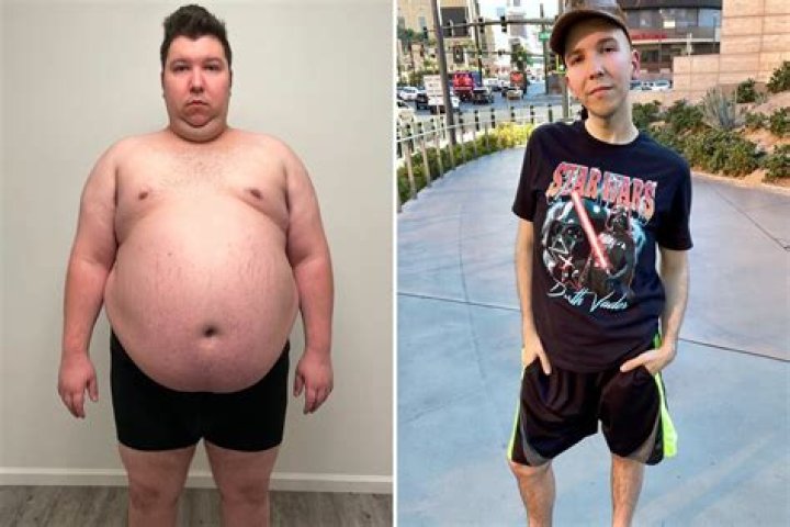 Nikocado Avocado before and after How much does the YouTuber weigh now