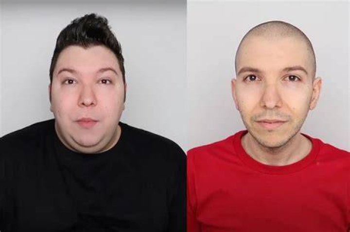 Nikocado Before And After Digital Global Times
