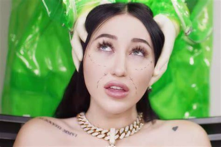 Noah Cyrus Goes Under the Knife in Gory &lsquo;FckYouNoah&rsquo; Video Rolling Stone