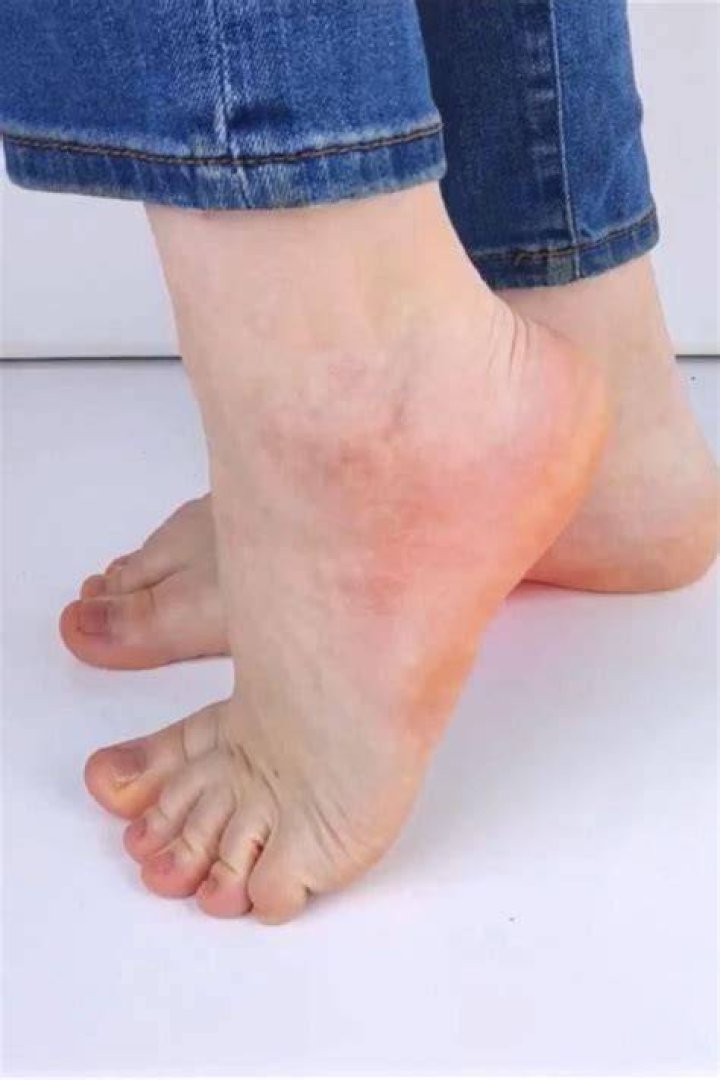 Pin on Foot
