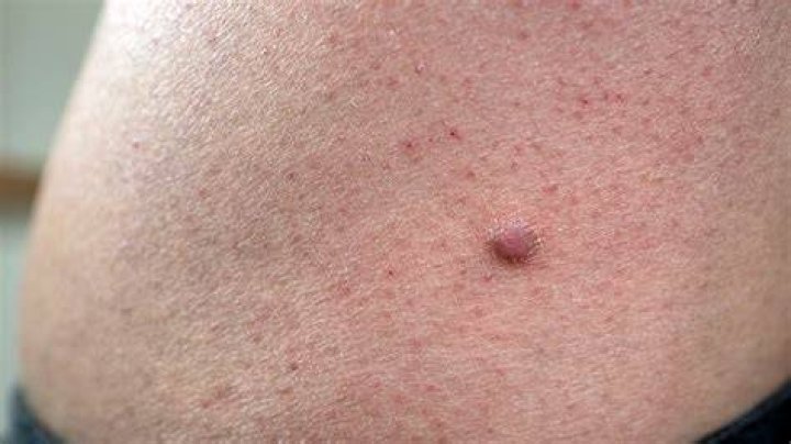 Pin on N&ouml;je