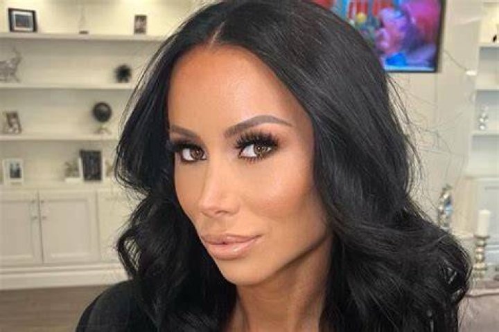 Rachel Fuda Shows Her New Teeth After Getting Veneers See Before