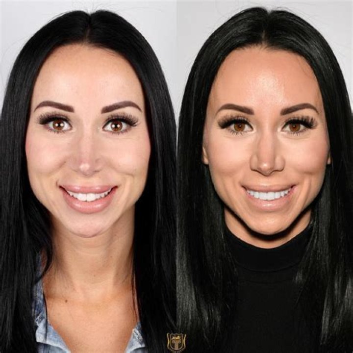 Rachel Fuda&rsquo;s Before Plastic Surgery What Procedures Has She Undergone