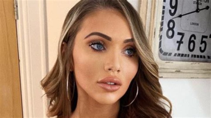 Reality star reveals breast implant flipped over and burst inside her