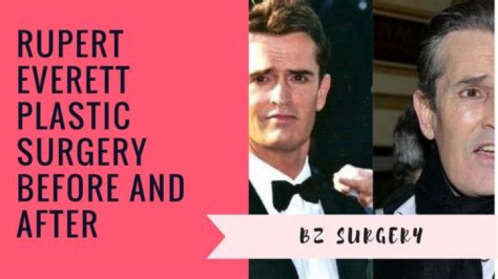 Rupert Everett Plastic Surgery Before and After Pictures 2024