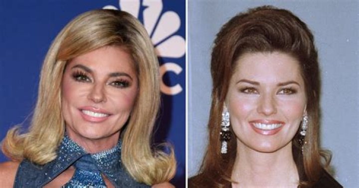 Shania Twain Plastic Surgery What Work Has the Singer Gotten Done?